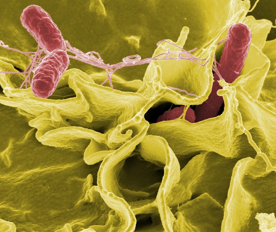 SALMONELLA TYPHI – CO WYWOŁUJE I JAK JĄ LECZYĆ?